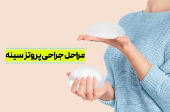 مراحل جراحی پروتز سینه