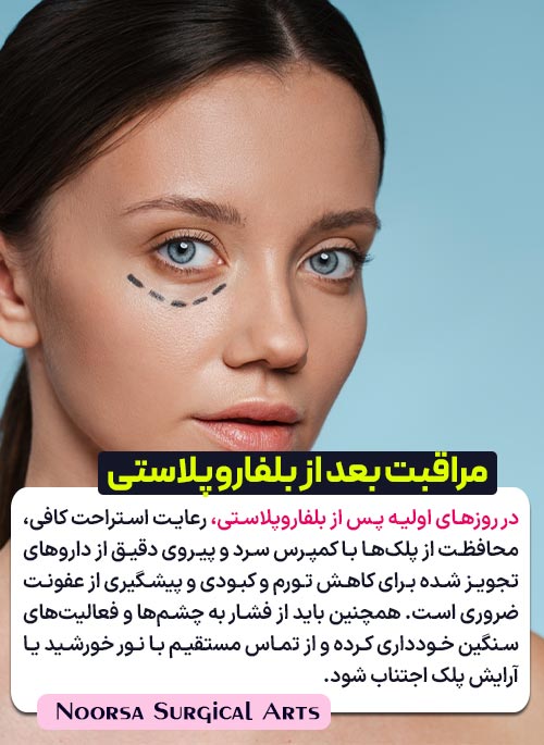 مراقبت های بعد از جراحی پلک