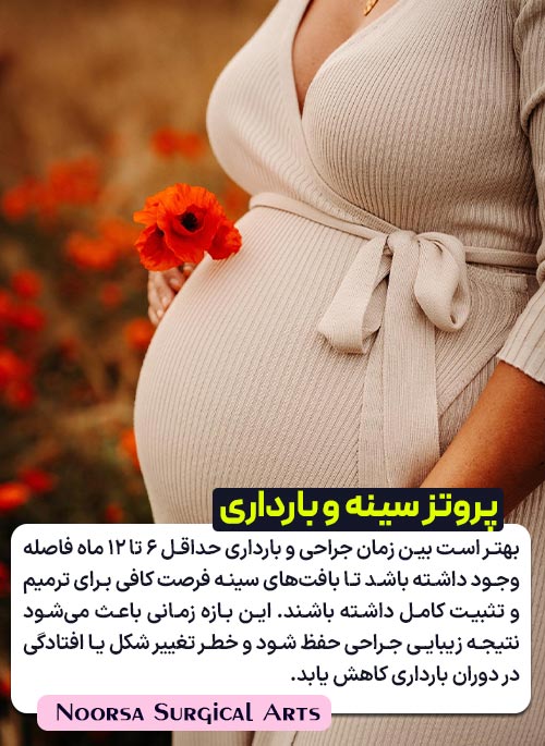 پروتز سینه در زمان بارداری