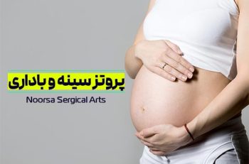 پروتز سینه و بارداری