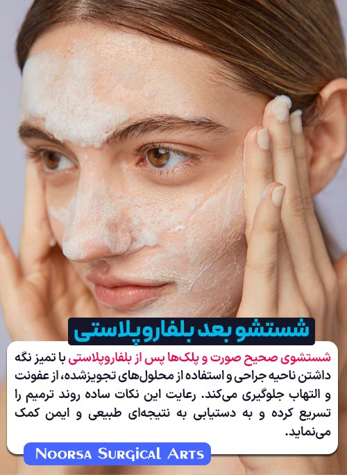 نحوه شستشوی صورت بعد از بلفاروپلاستی
