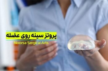 پروتز سینه روی عضله چیست