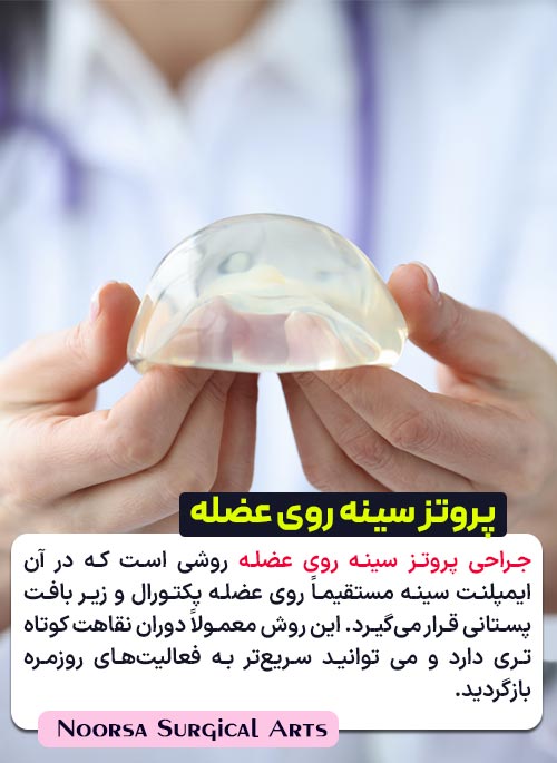 پروتز سینه روی عضله