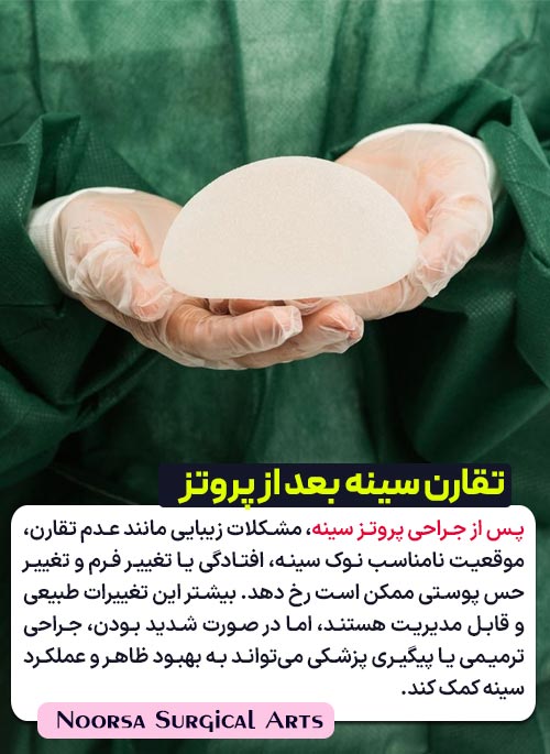 تقارن سینه بعد از پروتز سینه