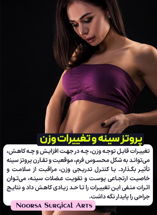 تاثیر تغییرات وزن بر پروتز سینه