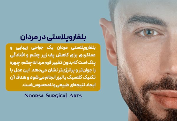 بلفاروپلاستی در مردان