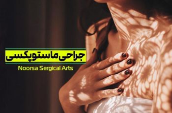 جراحی ماستوپکسی