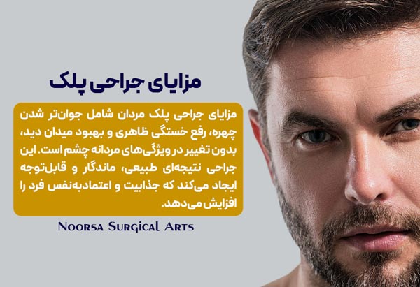 مزایای جراحی پلک آقایان