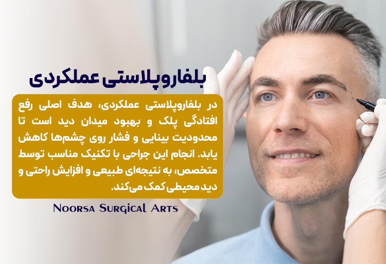 بلفاروپلاستی عملکردی چیست