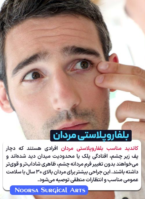 کاندید مناسب بلفاروپلاستی مردان