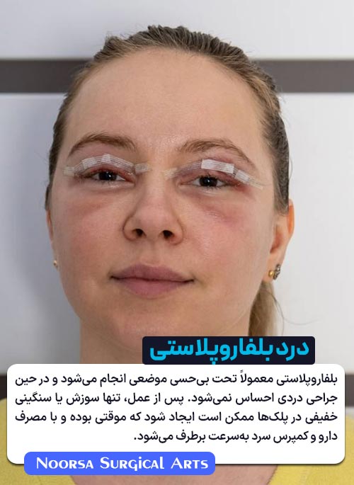 میزان درد بلفاروپلاستی