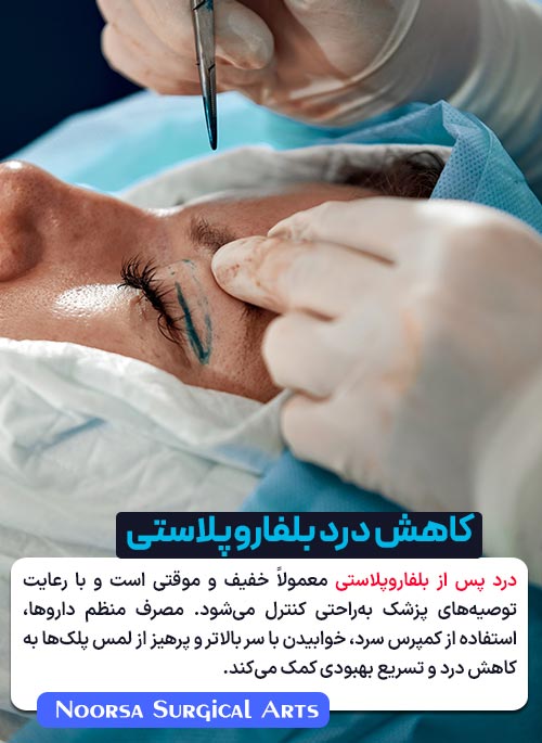 کاهش درد بلفاروپلاستی