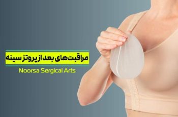 مراقبت های بعد از جراحی پروتز سینه