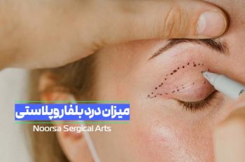 میزان درد جراحی بلفاروپلاستی