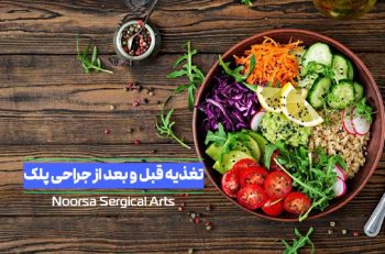 تغذیه قبل و بعد از جراحی پلک