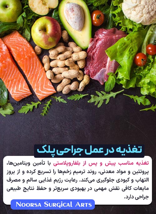 تغذیه بعد از عمل جراحی بینی