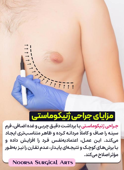 مزایای جراحی ژنیکوماستی