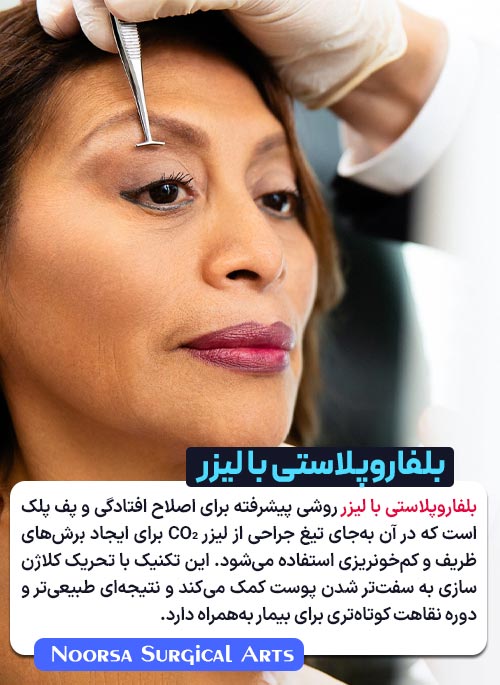 بلفاروپلاستی با لیزر