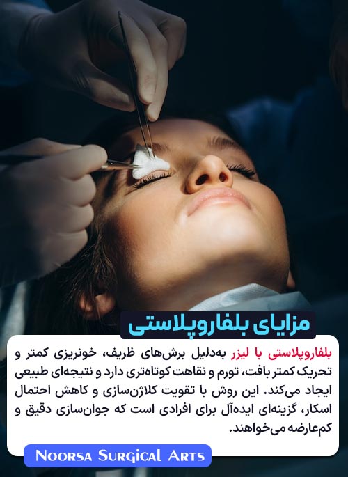مزایای بلفاروپلاستی با لیزر