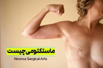 ماستکتومی چیست