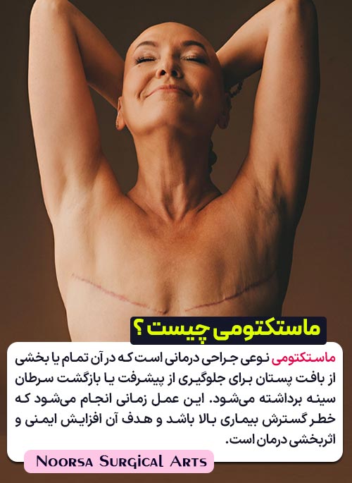 تعریف جراحی ماستکتومی