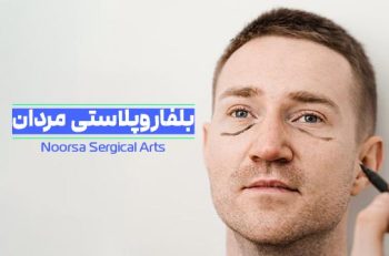 بلفاروپلاستی مردان