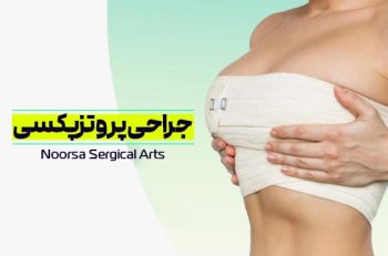 جراحی پروتزپکسی