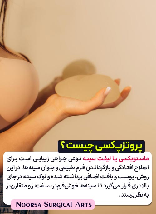 جراحی پروتزپکسی چیست