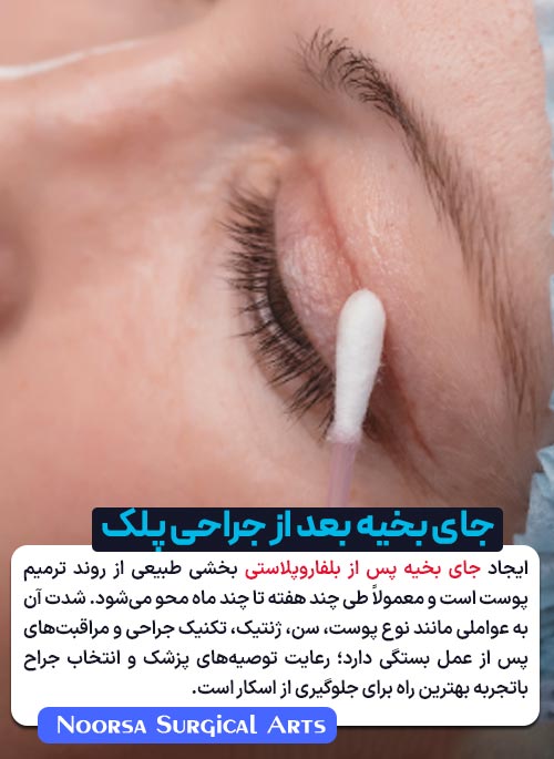 جای بخیه بعد از عمل جراحی پلک