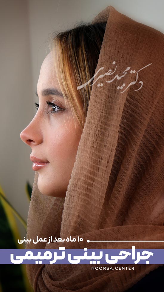 نتیجه جراحی بینی ترمیمی