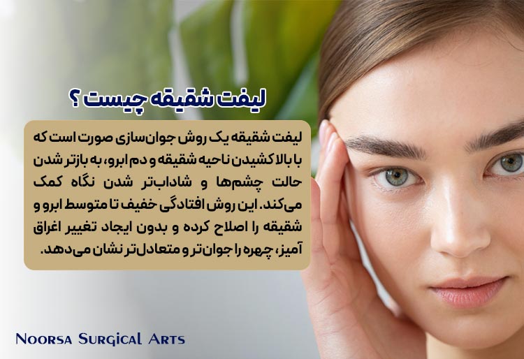 لیفت شقیقه چیست