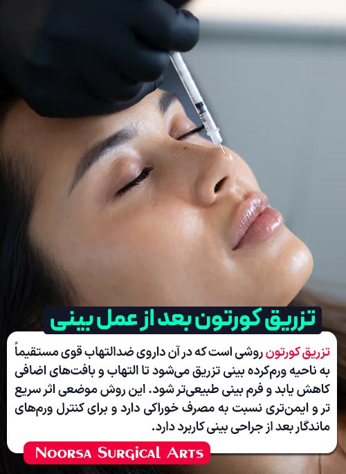 تزریق کورتون بعد از عمل بینی