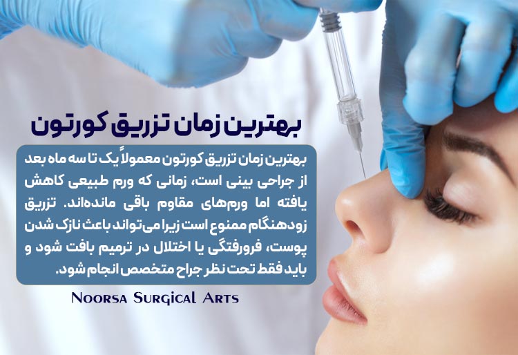 بهترین زمان تزریق کورتون به بینی بعد از جراحی