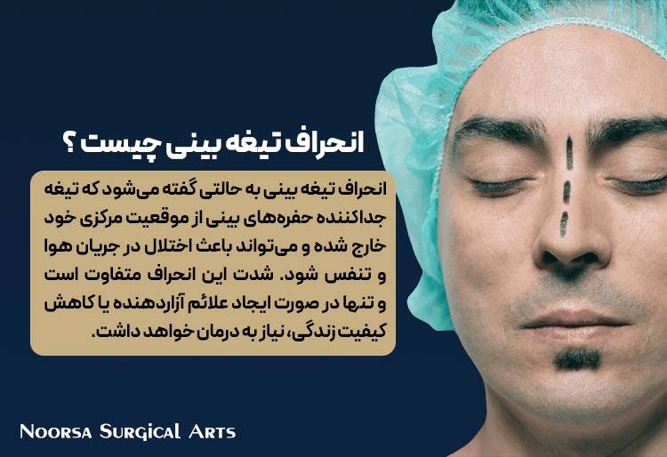 انحراف تیغه بینی چیست