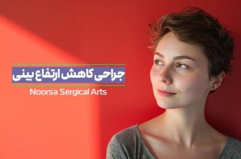 جراحی کاهش ارتفاع بینی