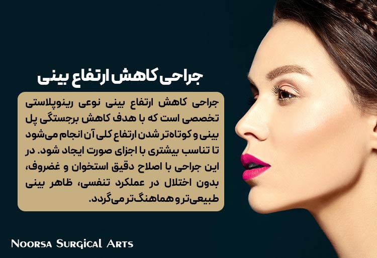 جراحی کاهش ارتفاع بینی