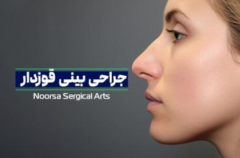 جراحی بینی قوزدار