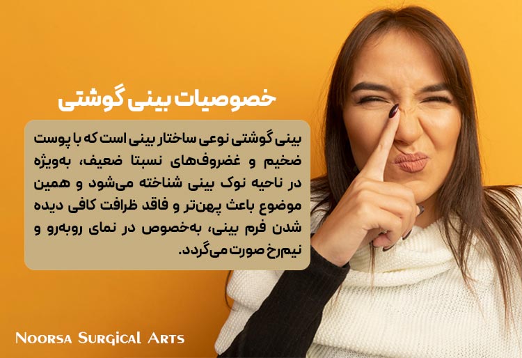 خصوصیات بینی گوشتی