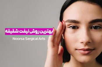 بهترین روش لیفت شقیقه