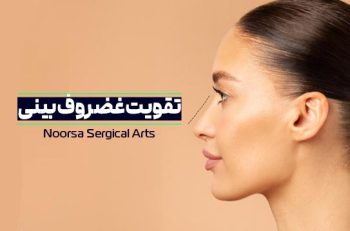 تقویت غضروف بینی برای جراحی
