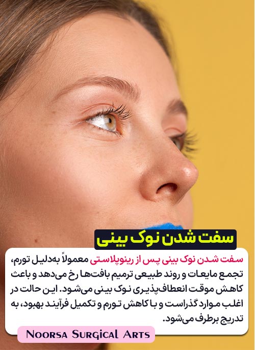 سفت شدن نوک بینی بعد از عمل