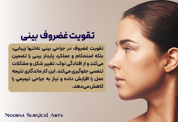 تقویت غضروف بینی