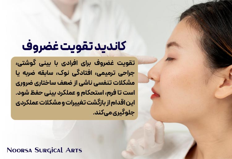 کاندید مناسب تقویت غضروف