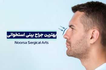 بهترین جراح بینی استخوانی