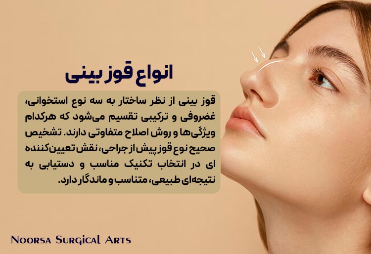 انواع قوز بینی