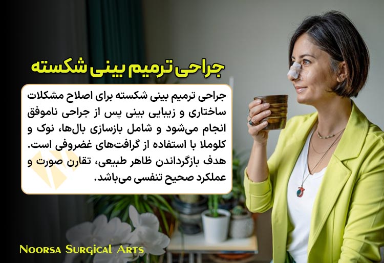 جراحی ترمیم بینی شکسته