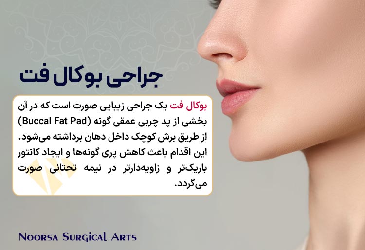 جراحی بوکال فت چیست