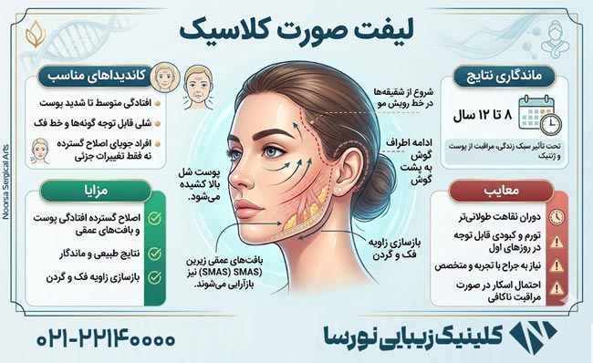 لیفت صورت کلاسیک