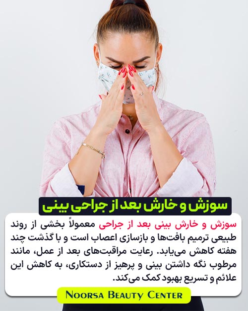 سوزش و خارش بعد از رینوپلاستی