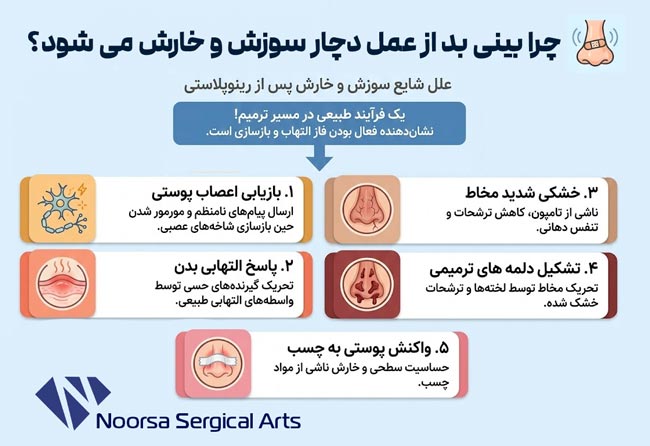 دلیل سوزش و خارش بعد از عمل بینی